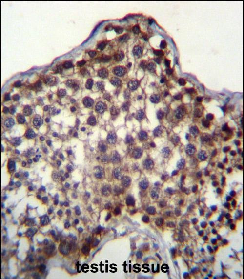 PQLC2 Antibody in Immunohistochemistry (Paraffin) (IHC (P))