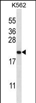 GAGE2B Antibody in Western Blot (WB)