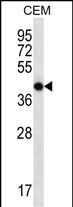 OR7G2 Antibody in Western Blot (WB)