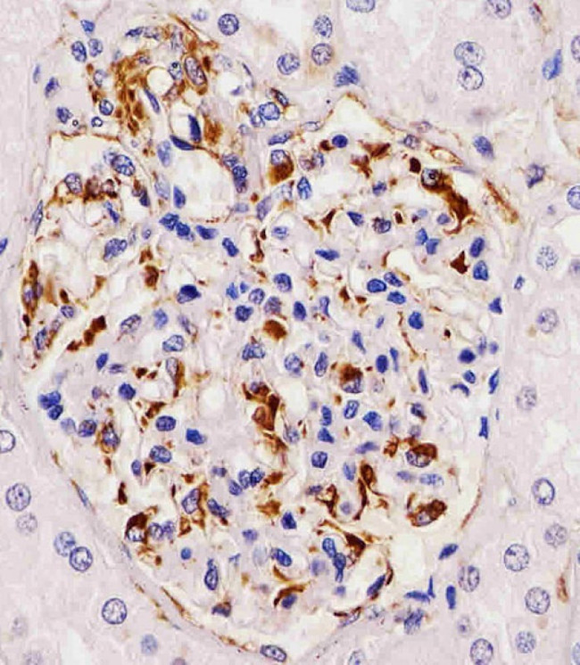 RHBDF2 Antibody in Immunohistochemistry (Paraffin) (IHC (P))