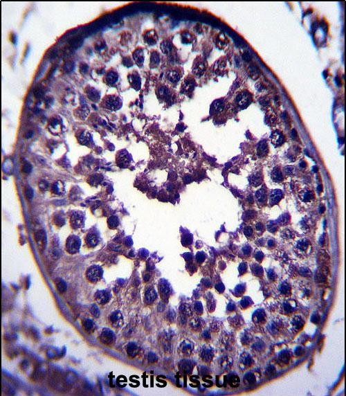 GAGE12H Antibody in Immunohistochemistry (Paraffin) (IHC (P))