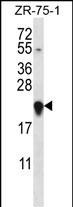 GAGE12H Antibody in Western Blot (WB)