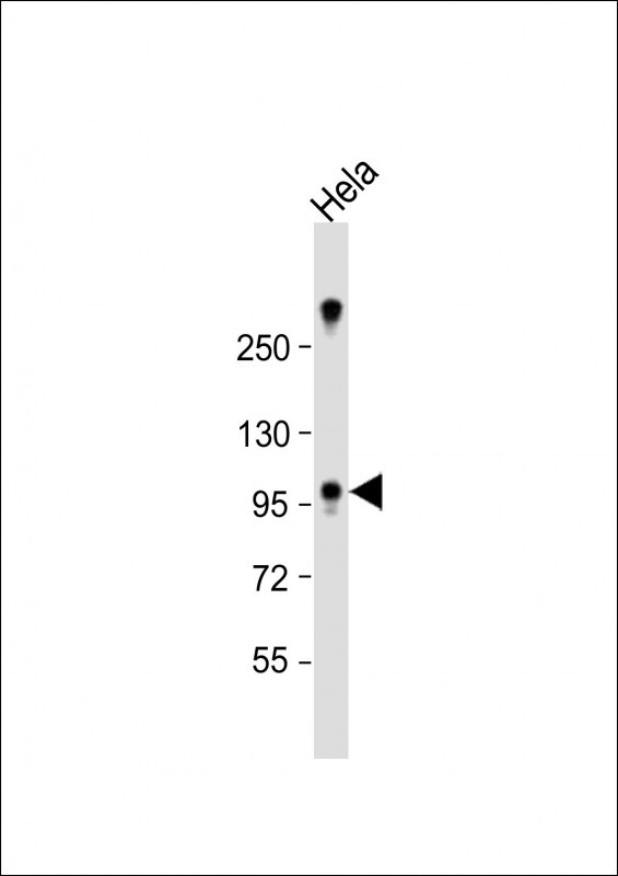 ZCCHC14 Antibody in Western Blot (WB)