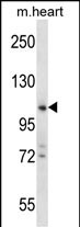 ZCCHC14 Antibody in Western Blot (WB)