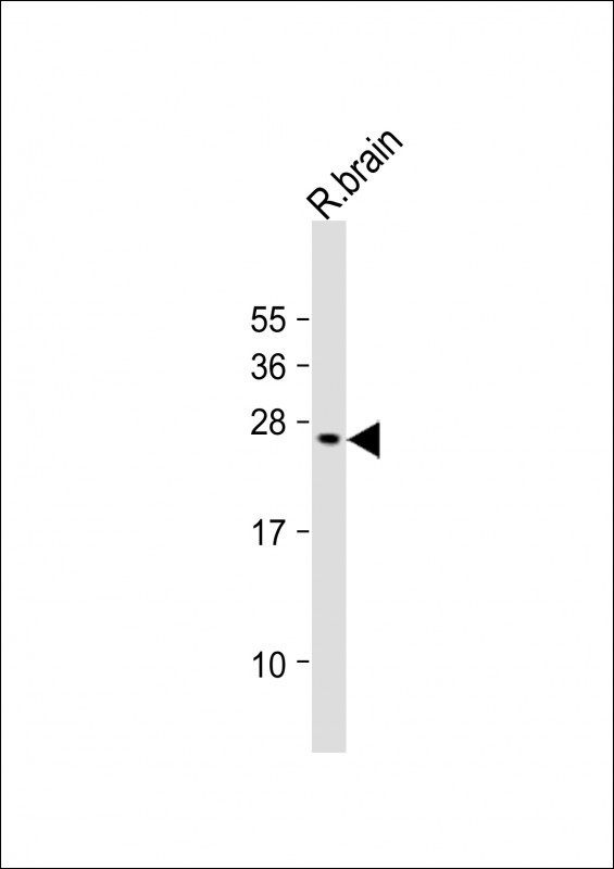 VKORC1L1 Antibody in Western Blot (WB)