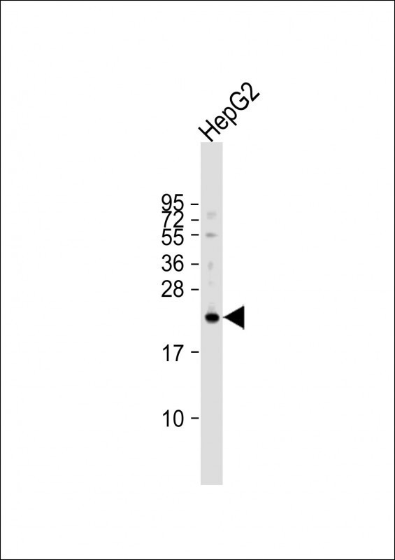 VKORC1L1 Antibody in Western Blot (WB)