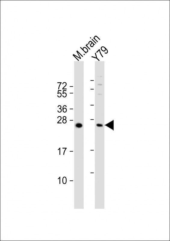 VKORC1L1 Antibody in Western Blot (WB)