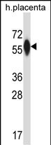 P4HA3 Antibody in Western Blot (WB)