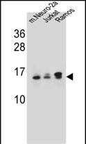 UBE2E2 Antibody in Western Blot (WB)