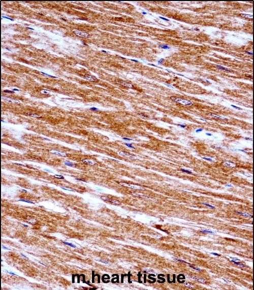 NEK6 Antibody in Immunohistochemistry (Paraffin) (IHC (P))