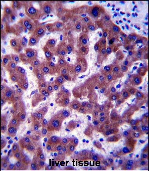 SC4MOL Antibody in Immunohistochemistry (Paraffin) (IHC (P))