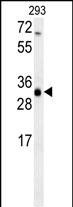 SC4MOL Antibody in Western Blot (WB)