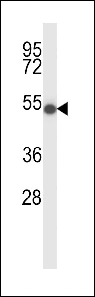 ZDHHC16 Antibody in Western Blot (WB)