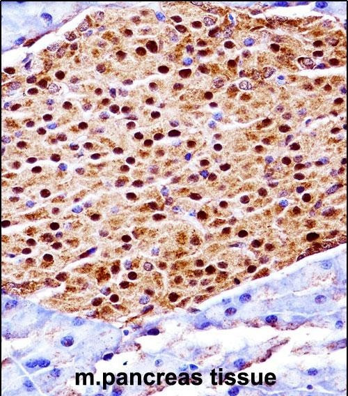 SCYL3 Antibody in Immunohistochemistry (Paraffin) (IHC (P))