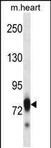 SCYL3 Antibody in Western Blot (WB)