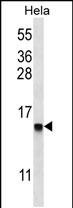 DEFB112 Antibody in Western Blot (WB)