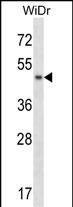 ANKS4B Antibody in Western Blot (WB)