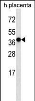 OR5H2 Antibody in Western Blot (WB)