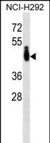 PABPC4L Antibody in Western Blot (WB)