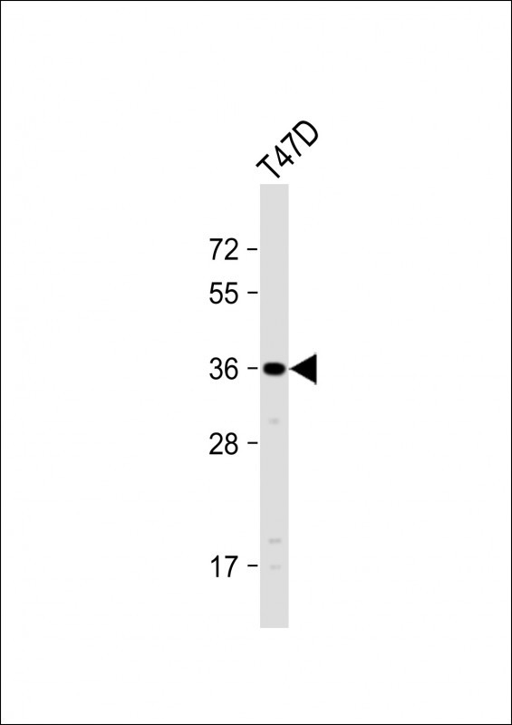 OR4D11 Antibody in Western Blot (WB)