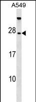 TBC1D28 Antibody in Western Blot (WB)