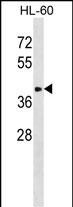 ST8SIA6 Antibody in Western Blot (WB)