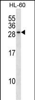 RAB15 Antibody in Western Blot (WB)