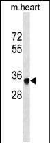 Sbk2 Antibody in Western Blot (WB)