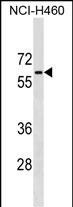 PGM5 Antibody in Western Blot (WB)