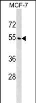 WDR20 Antibody in Western Blot (WB)