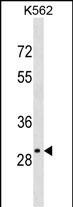 OR4S2 Antibody in Western Blot (WB)