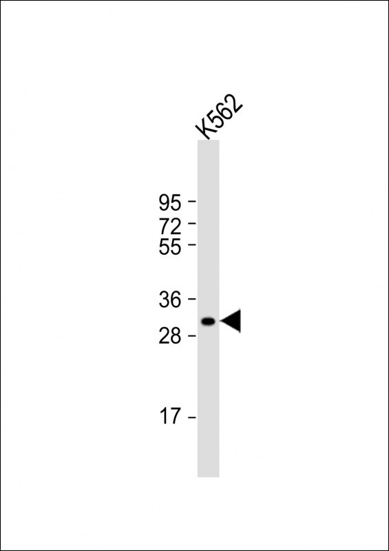 NKX6-2 Antibody in Western Blot (WB)