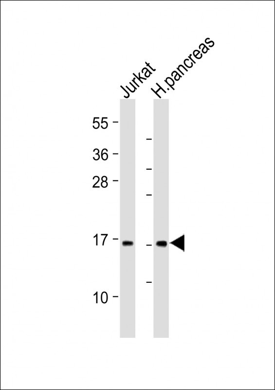 EMP3 Antibody in Western Blot (WB)