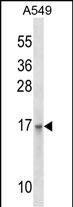 EMP3 Antibody in Western Blot (WB)