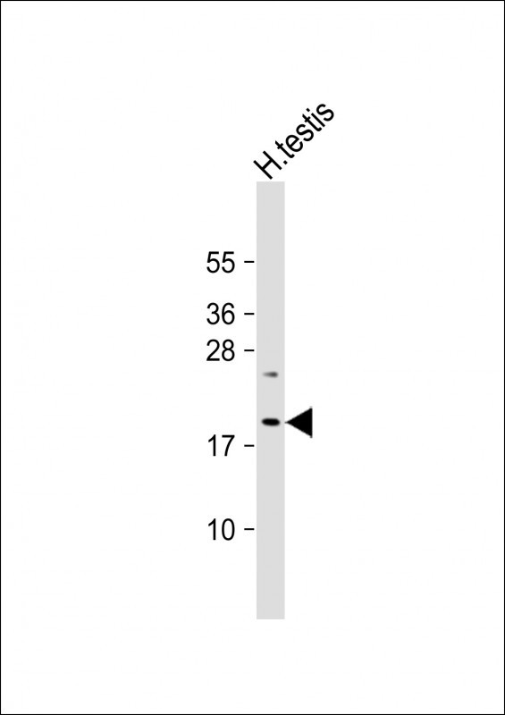 VCX3A Antibody in Western Blot (WB)