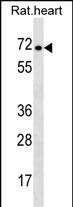 STRA6 Antibody in Western Blot (WB)