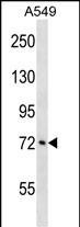 ATXN1L Antibody in Western Blot (WB)