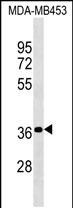 PSG4 Antibody in Western Blot (WB)