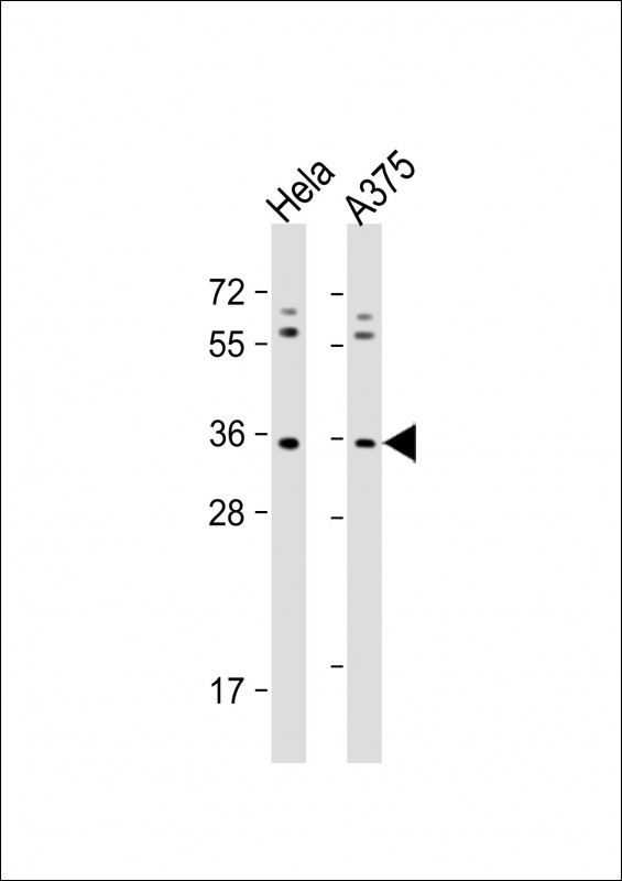 OR5AK2 Antibody in Western Blot (WB)