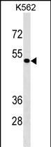 ZNF733 Antibody in Western Blot (WB)