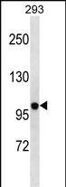 KV2.2 (KCNB2) Antibody in Western Blot (WB)