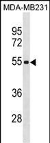 ZSCAN5C Antibody in Western Blot (WB)