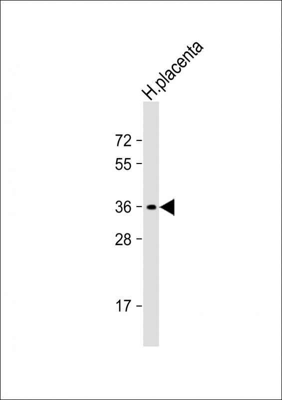 OR8A1 Antibody in Western Blot (WB)