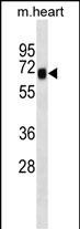 SHC4 Antibody in Western Blot (WB)