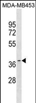 OR11A1 Antibody in Western Blot (WB)