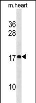 DAPL1 Antibody in Western Blot (WB)