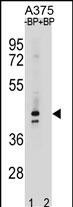 OR5AC2 Antibody in Western Blot (WB)