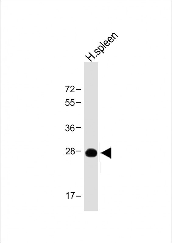 PRSSL1 Antibody in Western Blot (WB)