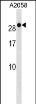 RAB7B Antibody in Western Blot (WB)