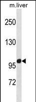 ZNF865 Antibody in Western Blot (WB)